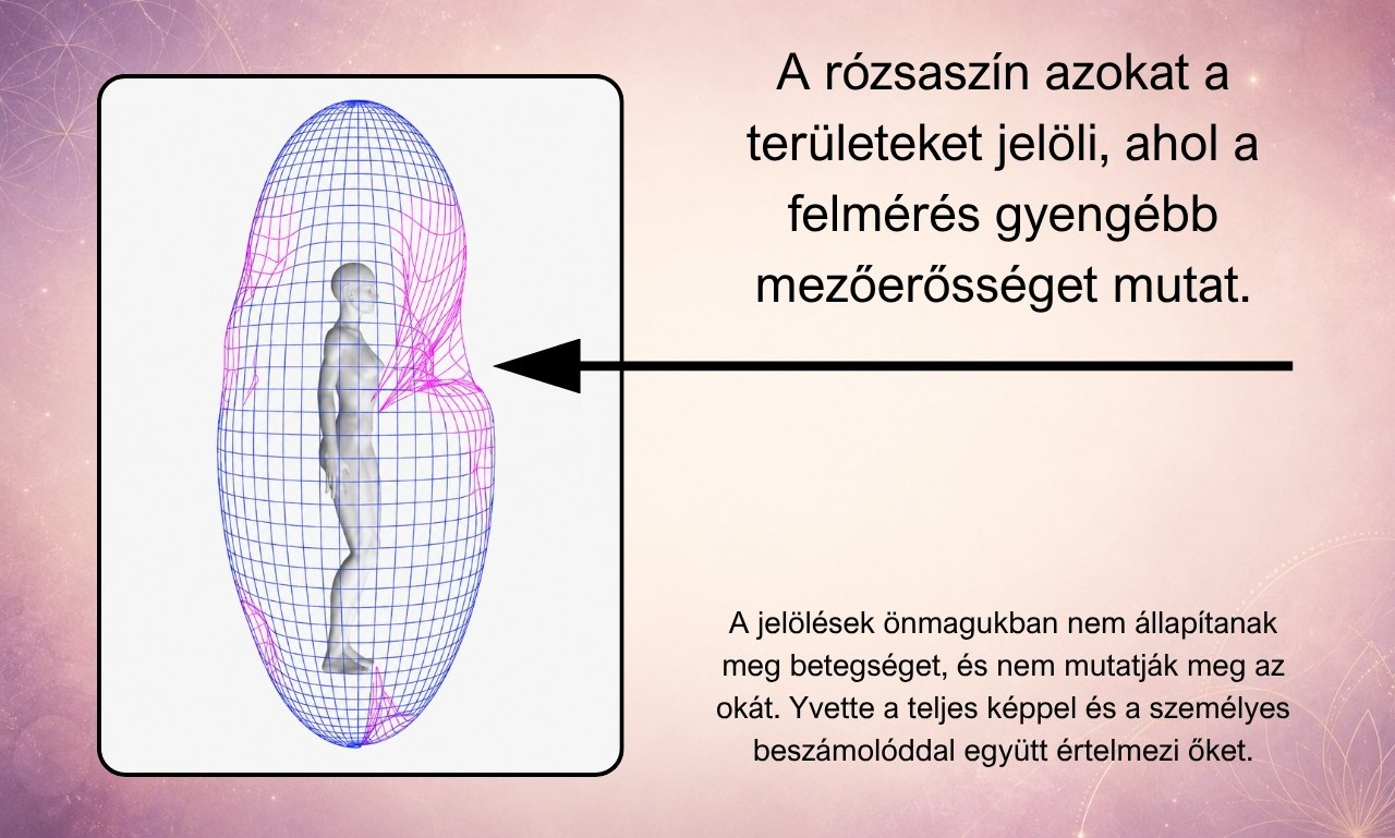 Biomező-megjelenítés egy mutatóval, amely a szoftver által gyengébb mezőerősségként kiemelt rózsaszín területekre mutat