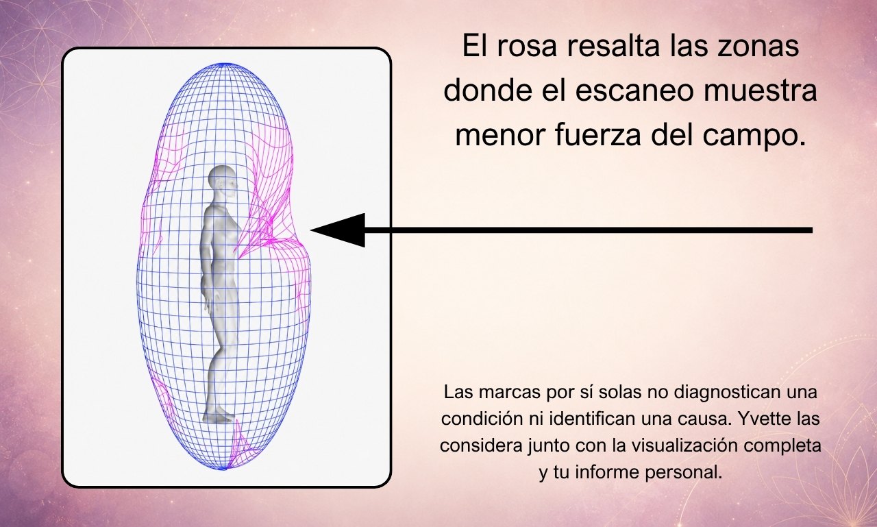 Visualización del biocampo con un indicador que señala las zonas rosadas que el software resalta como de menor fuerza del campo